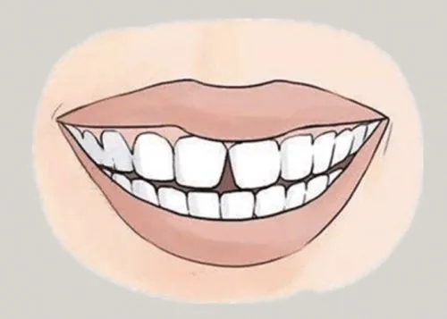 <a href=http://99bb.com.cn/news_article?news_id=116>一次性口腔探針</a>